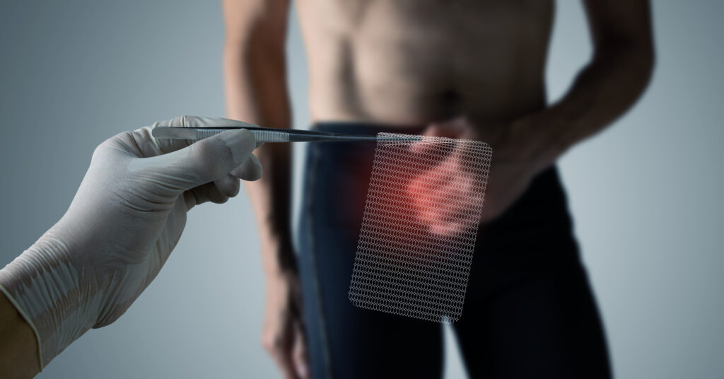 Hernia treatment: What to know about surgery and recovery - The Bradford Era
