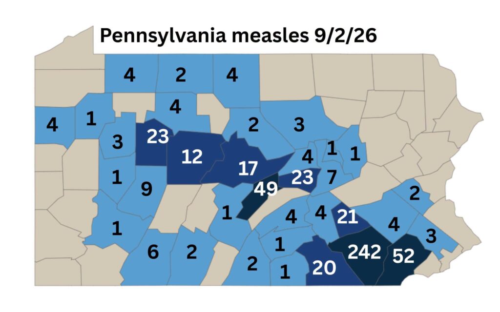 Two Measles Cases Found Mckean County